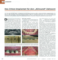 Das Zirkon-Implantat für den „Allround“-Zahnarzt