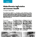 Minimalinvasive Implantation
mit internem Sinuslift